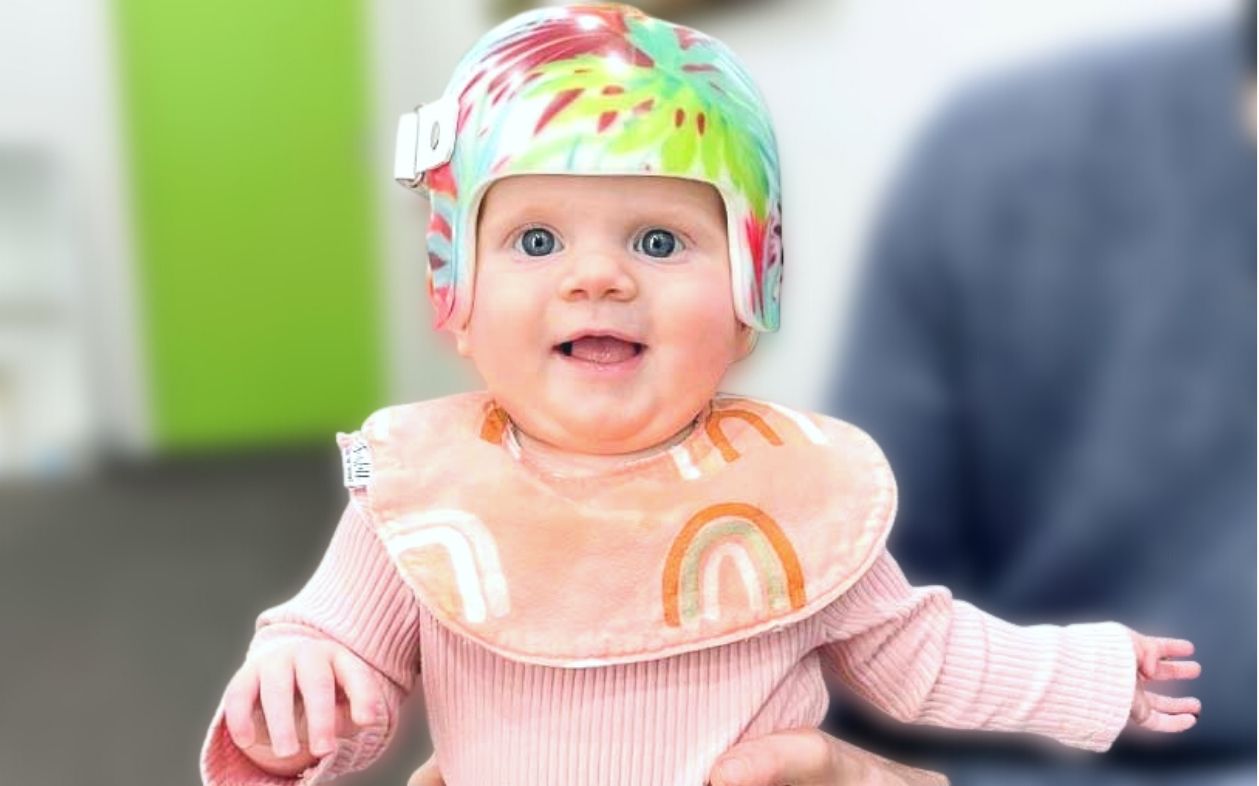 Plagiocephaly Helmets For Babies Melbourne Massons Healthcare